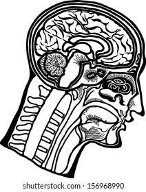 Vector graphic of a dissected human head showing an exposed skull and brain. 