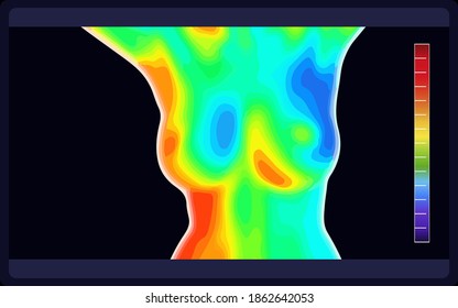 Vektorgrafik von thermografischem Bild der Brust auf schwarzem Hintergrund. Die Brust der Frau zeigt unterschiedliche Temperaturen in verschiedenen Farben, von blau über kalt bis rot, mit heißer Farbe. Vektor eps10.
