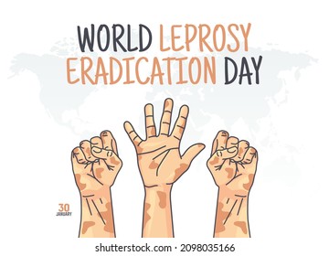 vector graphic of world leprosy eradication day good for world leprosy eradication day celebration. flat design. flyer design. flat illustration.