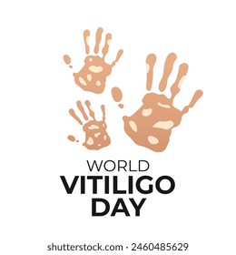 vector graphic of World Vitiligo Day ideal for World Vitiligo Day celebration.