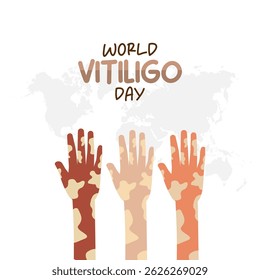 Vector graphic of World Vitiligo Day for World Vitiligo Day celebration.