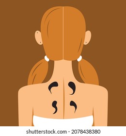 Vector graphics - the back of the head of a young woman with a hairstyle from the back with bare shoulders and four black leeches on the skin. Concept - hirudotherapy - alternative medicine