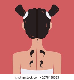 Vector graphics - the back of the head of a young woman with a hairstyle from the back with bare shoulders and four black leeches on the skin. Concept - hirudotherapy - alternative medicine