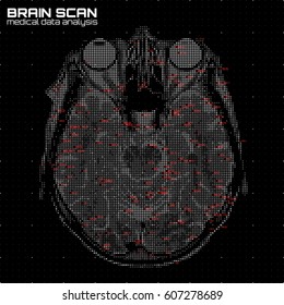 Vector Grayscale Abstract Brain Tomography Analysis Illustration. Digital Brain X-ray Scan. Medical Data MRI Visualization Concept. Futuristic Healthcare Software HUD UI. Data Driven Image. Human Head