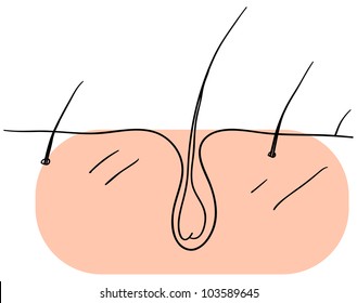 Vector hair is growing in the skin