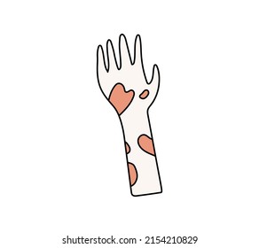 Vector mano con la despigmentación de vitiligo levantado en línea doodle estilo moderno. Ilustración abstracta aislada sobre fondo blanco.