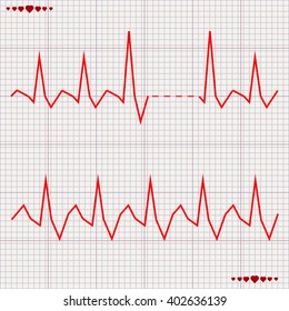 Vector - Heart beats cardiogram 