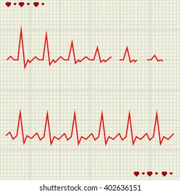 Vector - Heart beats cardiogram 