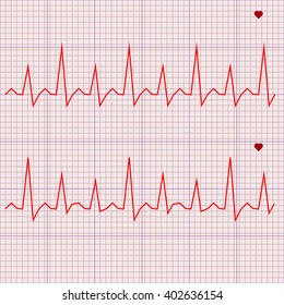 Vector - Heart beats cardiogram 