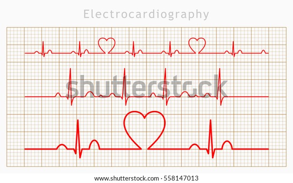 Vector Heart Cardiogram Charts Set Stock Vector Royalty Free 558147013