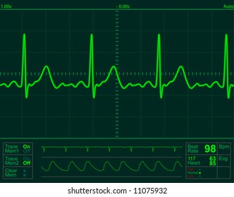Vector Heart Monitor Screen