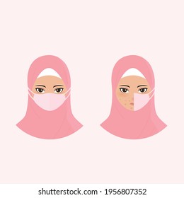 vector of hijab woman with skin problem with acne while wearing face mask
