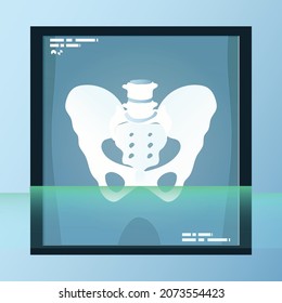vector of human bones, skeleton and joints on x-ray sheet. medical equipment illustration