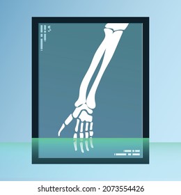 vector of human bones, skeleton and joints on x-ray sheet. medical equipment illustration