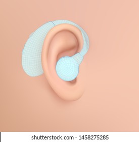 vector human ear. hearing treatment, plastic surgery, implantation