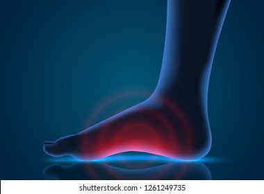 vector human foot. blue contour and red spots of pain. ready element for medicine and orthopedics