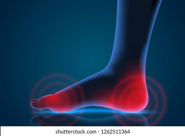 vector human foot. blue contour and red spots of pain. ready element for medicine and orthopedics