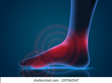 vector human foot. blue contour and red spots of pain. ready element for medicine and orthopedics