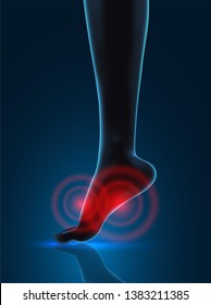 vector human foot. blue contour and red spots of pain. ready element for medicine and orthopedics