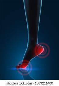 vector human foot. blue contour and red spots of pain. ready element for medicine and orthopedics