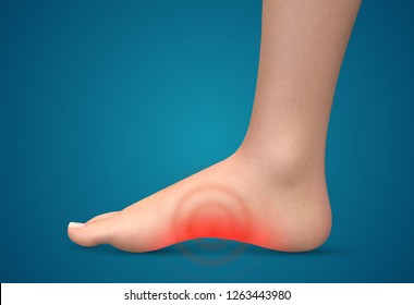 vector human foot.red spots of pain. ready element for medicine and orthopedics