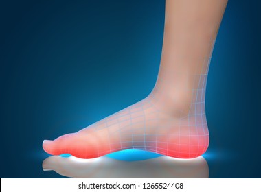 vector human foot.red spots of pain. ready element for medicine and orthopedics