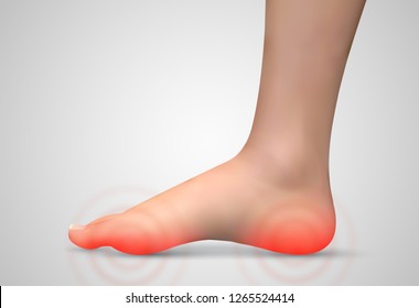 vector human foot.red spots of pain. ready element for medicine and orthopedics
