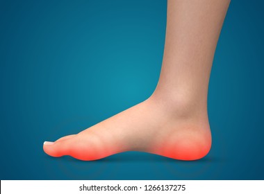 vector human foot.red spots of pain. ready element for medicine and orthopedics