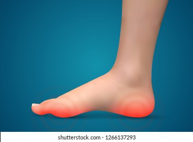 vector human foot.red spots of pain. ready element for medicine and orthopedics