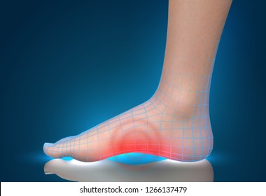 vector human foot.red spots of pain. ready element for medicine and orthopedics