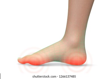 vector human foot.red spots of pain. ready element for medicine and orthopedics