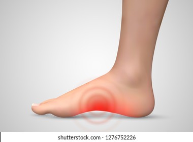 vector human foot.red spots of pain. ready element for medicine and orthopedics