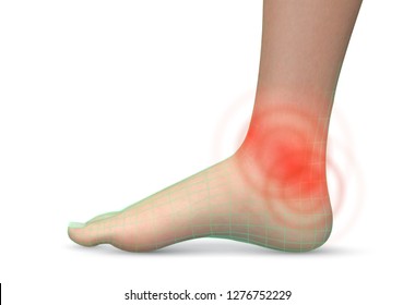 vector human foot.red spots of pain. ready element for medicine and orthopedics