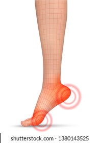 vector human foot.red spots of pain. ready element for medicine and orthopedics