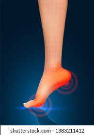 vector human foot.red spots of pain. ready element for medicine and orthopedics