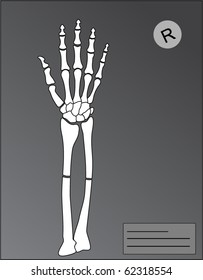 vector human hand roentgen