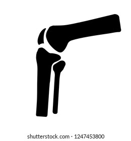vector human knee joint side view diagnosis