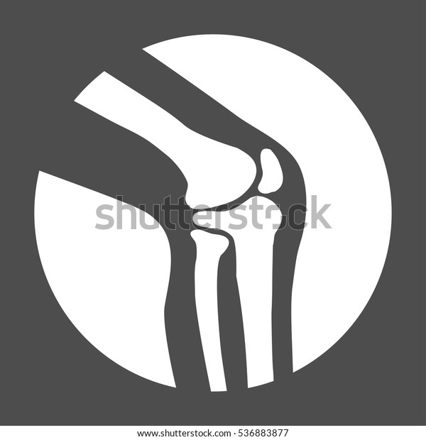 vector human knee\
joint side view\
diagnosis