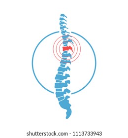 Vector Human Spine With Pain Isolated Silhouette Illustration. Spine Pain Medical Center, Clinic, Rehabilitation, Diagnostic, Surgery Logo Element. Spinal Icon Symbol Design. Concept Of Scoliosis