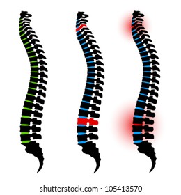 Vector Human Spine Silhouettes