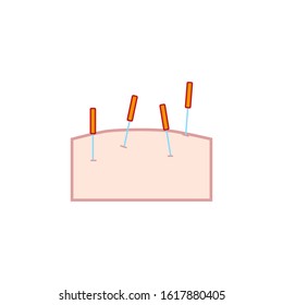 vector icon with acupuncture needles pinned to the skin