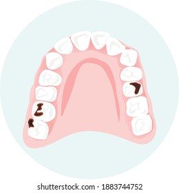 Vector icon of the lower jaw. Teeth with caries isolated