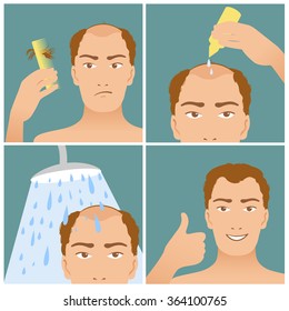 Vector icons set in flat design style with man who does procedures with his hair to prevent hair falling