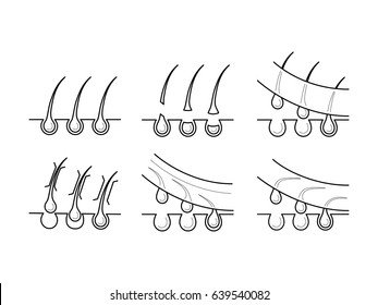 Hair Removal Set Stock Vectors Images Vector Art Shutterstock