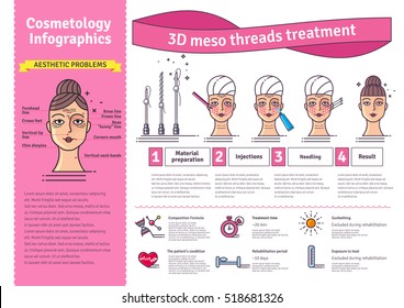 Vector Illustrated Set With 3d Meso Thread Face Lift Therapy. Infographics With Icons Of Medical Cosmetic Procedures For Skin.