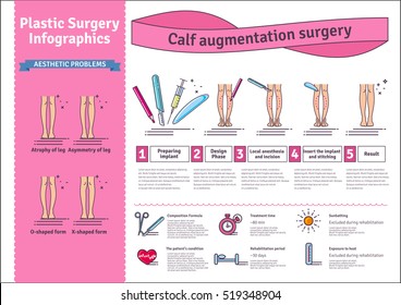 Vector Illustrated set with calf augmentation surgery. Infographics with icons of plastic surgery procedures.
