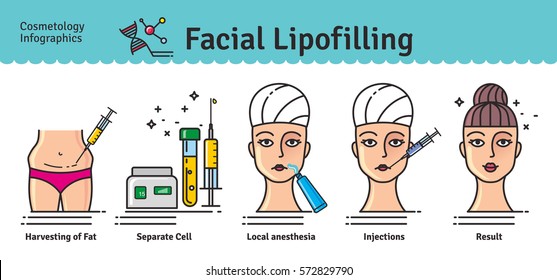 Vector Illustrated set with cosmetology facial lipofilling. Infographics with icons of medical cosmetic procedures.