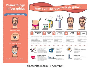 Vector Illustrated Set With Cosmetology Stem Cell Therapy For Hair Growth. Infographics With Icons Of Medical Cosmetic Procedures.