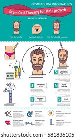Vector Illustrated Set With Cosmetology Stem Cell Therapy For Hair Growth. Infographics With Icons Of Medical Cosmetic Procedures.