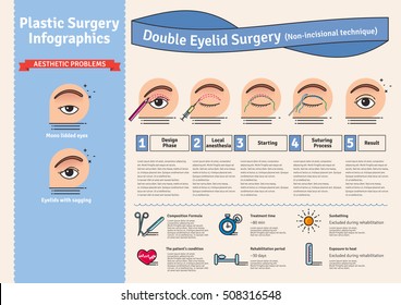 Vector Illustrated set with double eyelid surgery. Non-incisional technique. Infographics with icons of plastic surgery procedures.